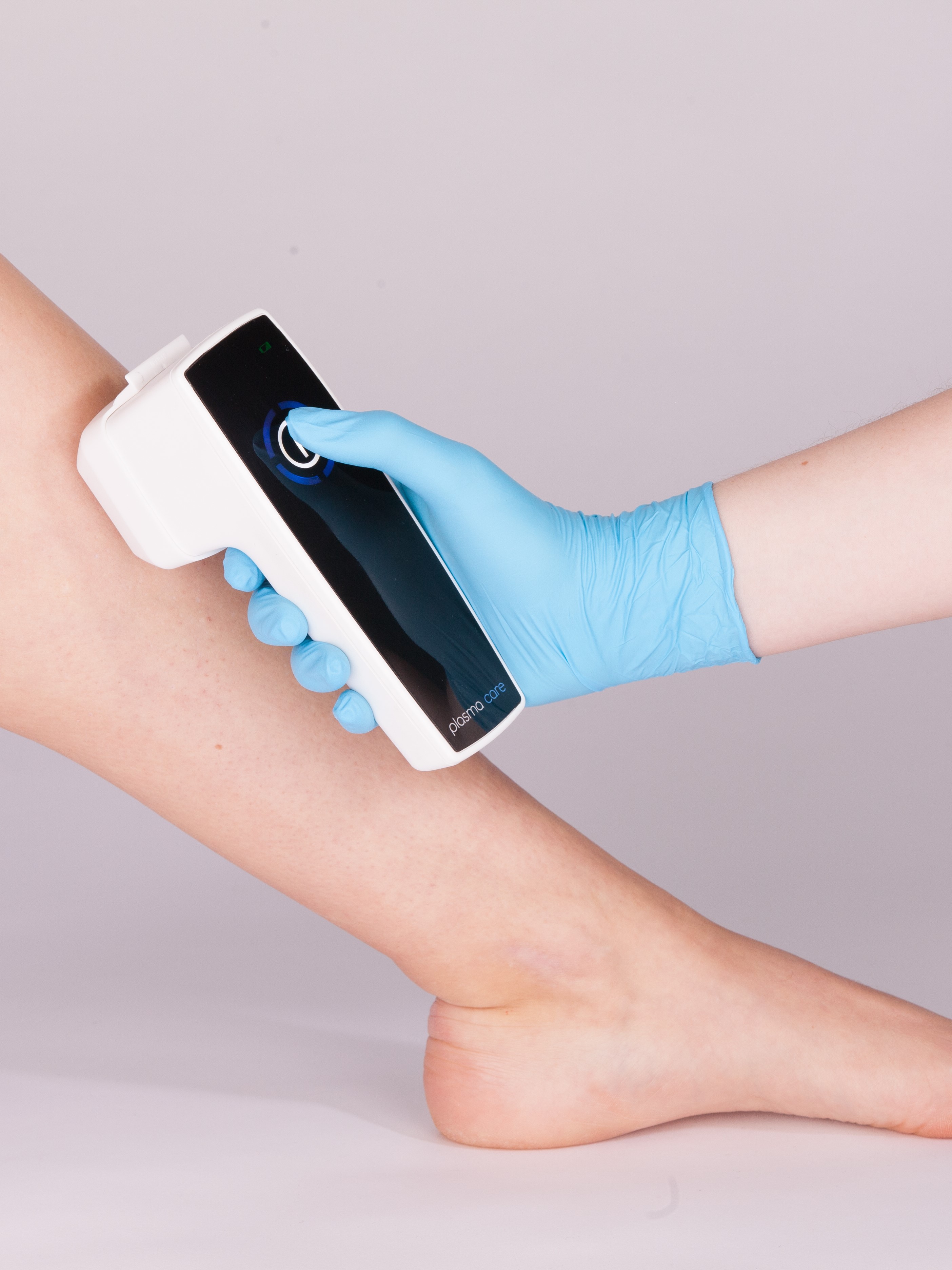 Kaltplasma-Behandlung am Bein mit einem Handgerät